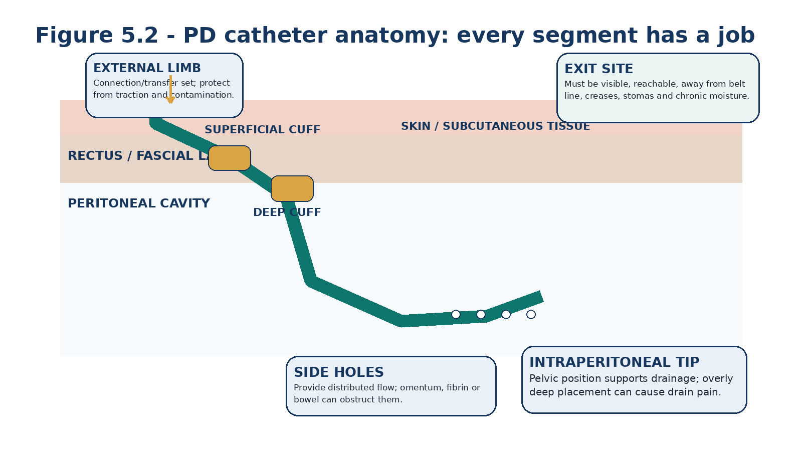 Figure 5.2 - Functional anatomy of a chronic PD catheter.
