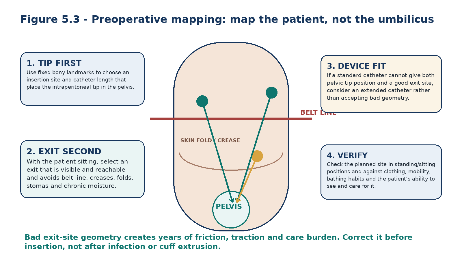Figure 5.3 - Preoperative mapping is an anthropometric problem.