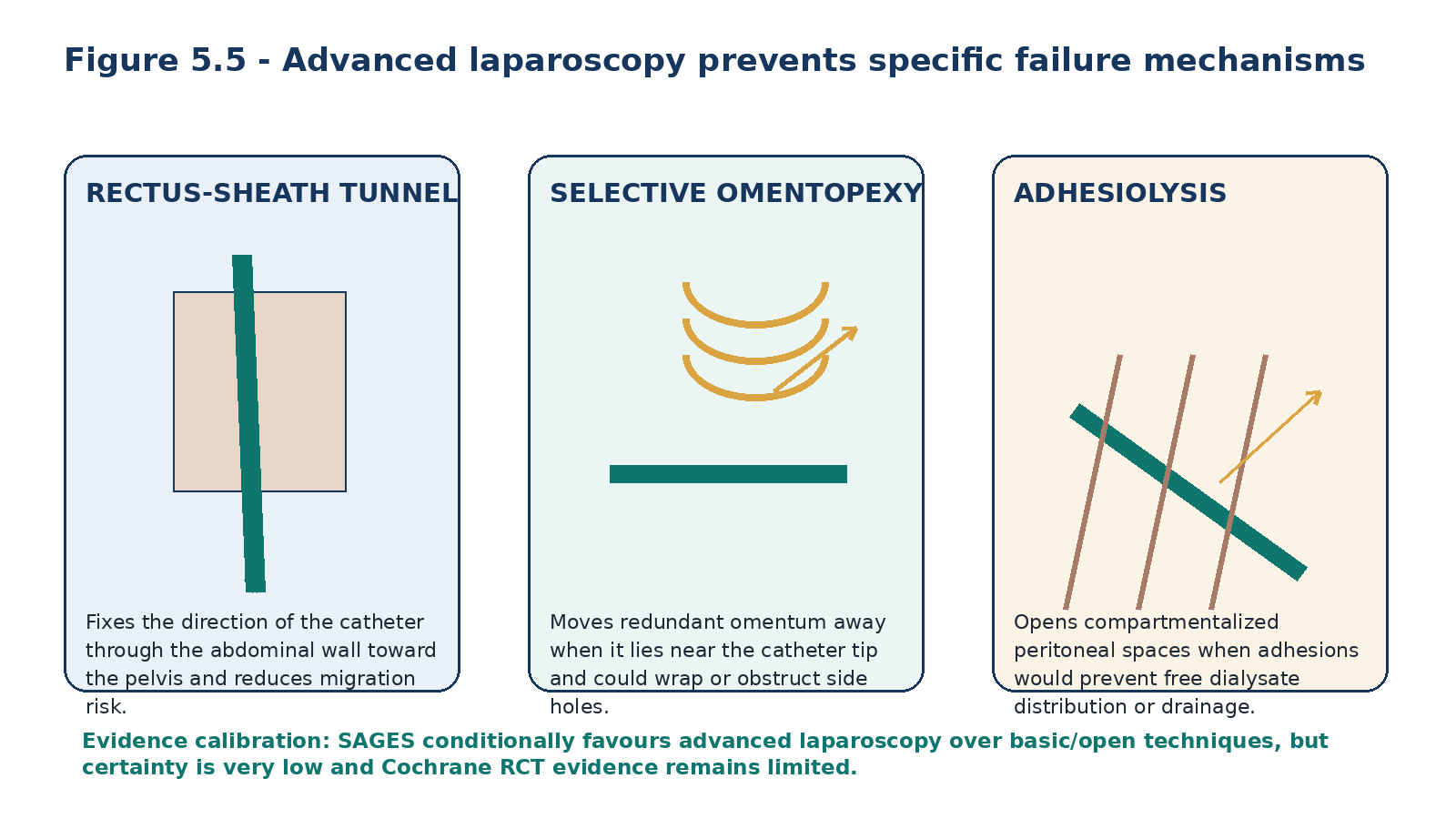 Figure 5.5 - Advanced laparoscopic adjuncts work by preventing defined mechanical failures: migration, omental obstruction and compartmentalized drainage.
