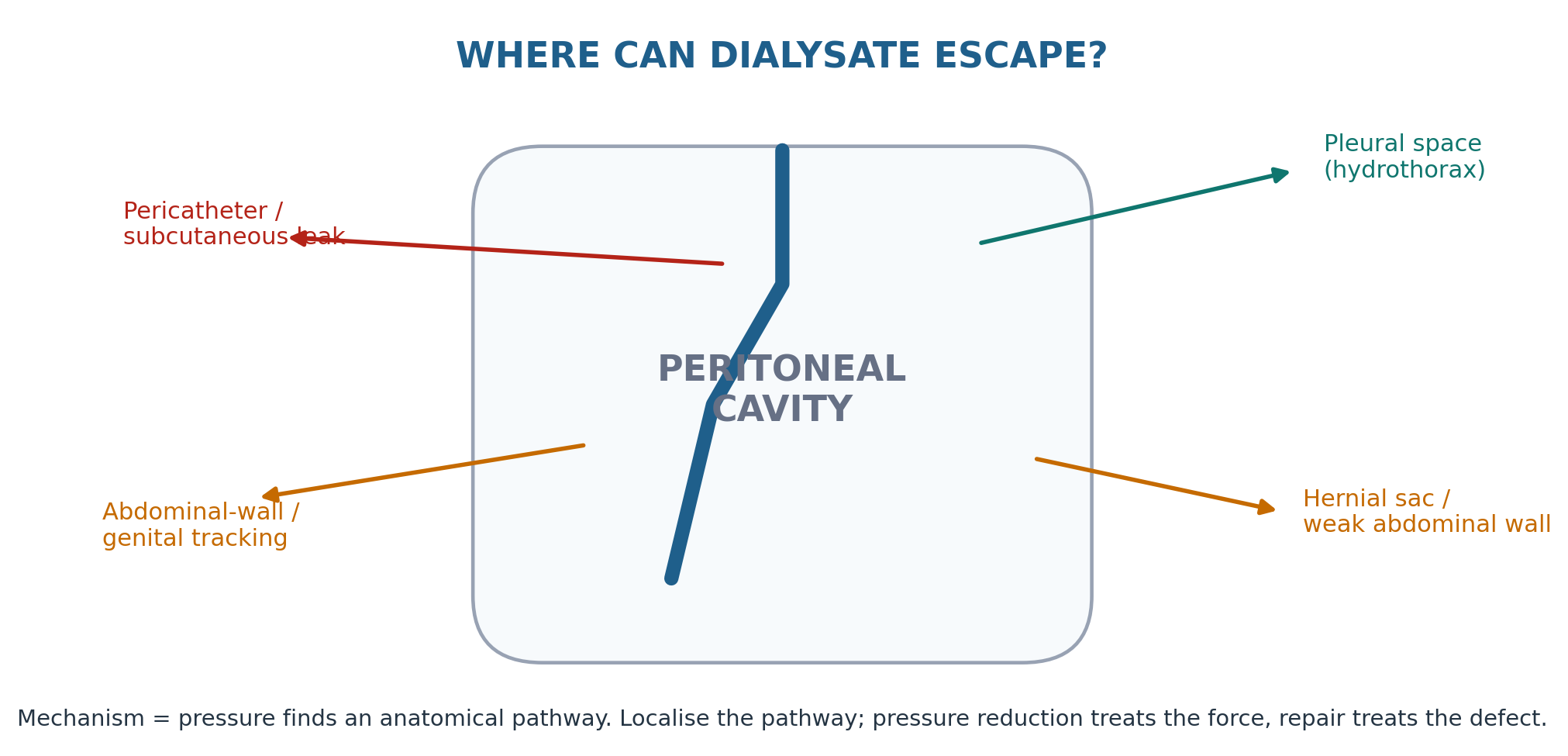 Figure 12.3 — Dialysate can escape through several pathways.