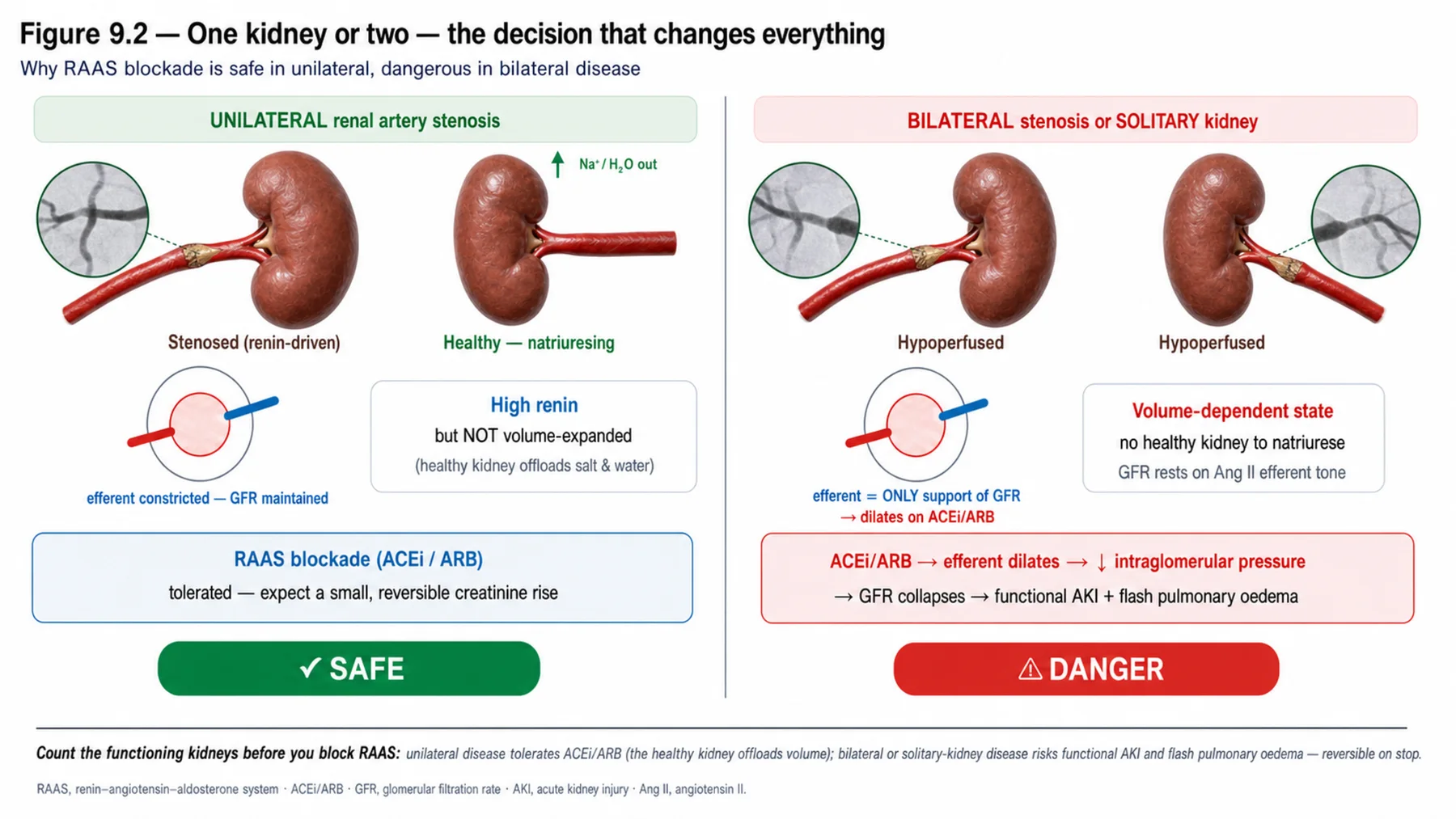 Figure 9.2 - One kidney or two - the decision that changes everything