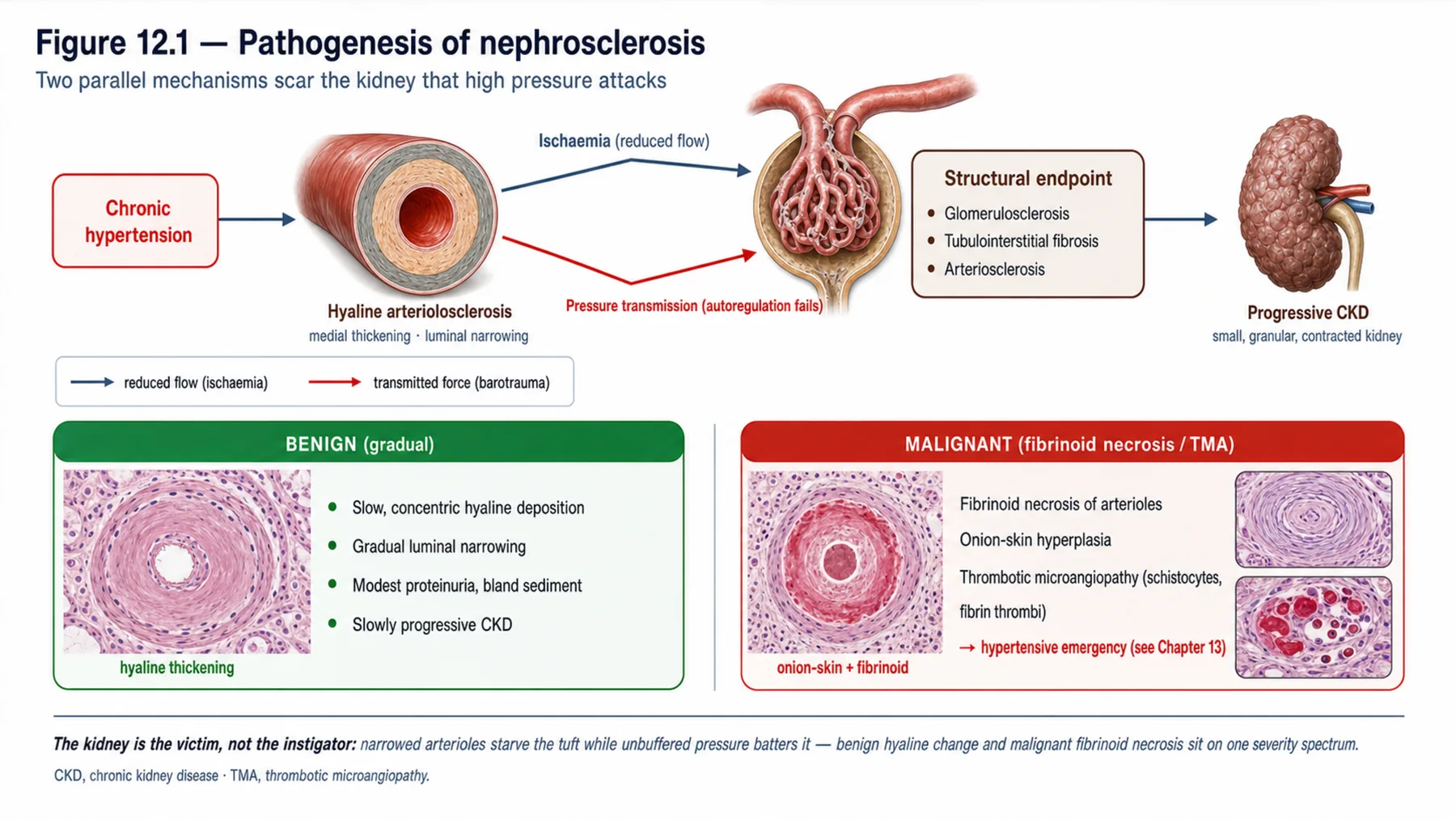 Figure 12.1 - Pathogenesis of nephrosclerosis