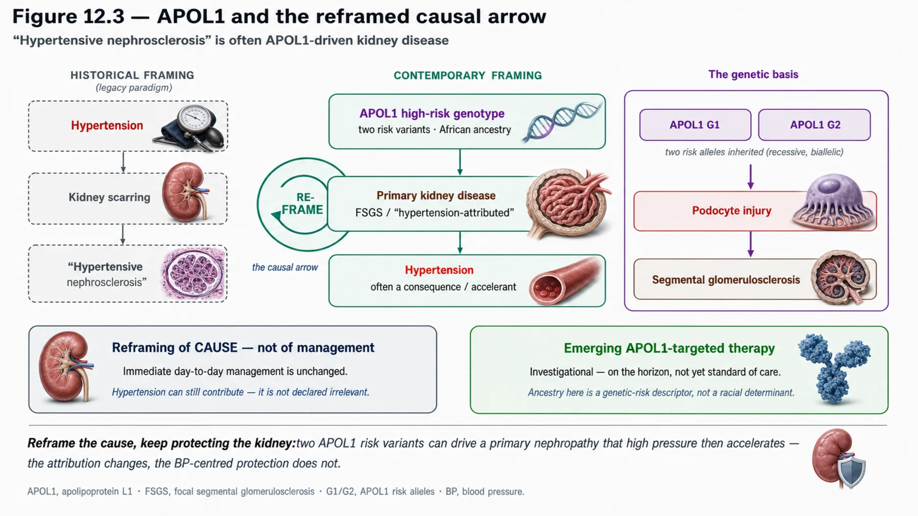 Figure 12.3 - APOL1 and the reframed causal arrow