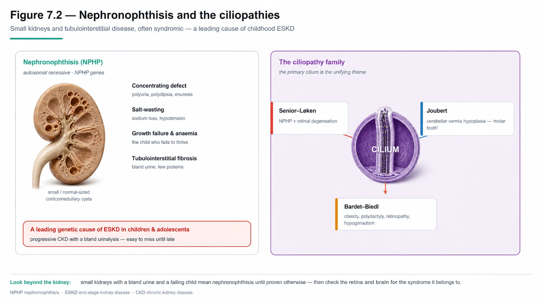 Figure 7.2 - Nephronophthisis and the ciliopathies