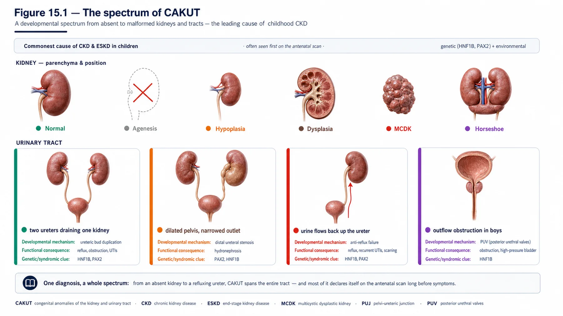 Figure 15.1 - The spectrum of CAKUT